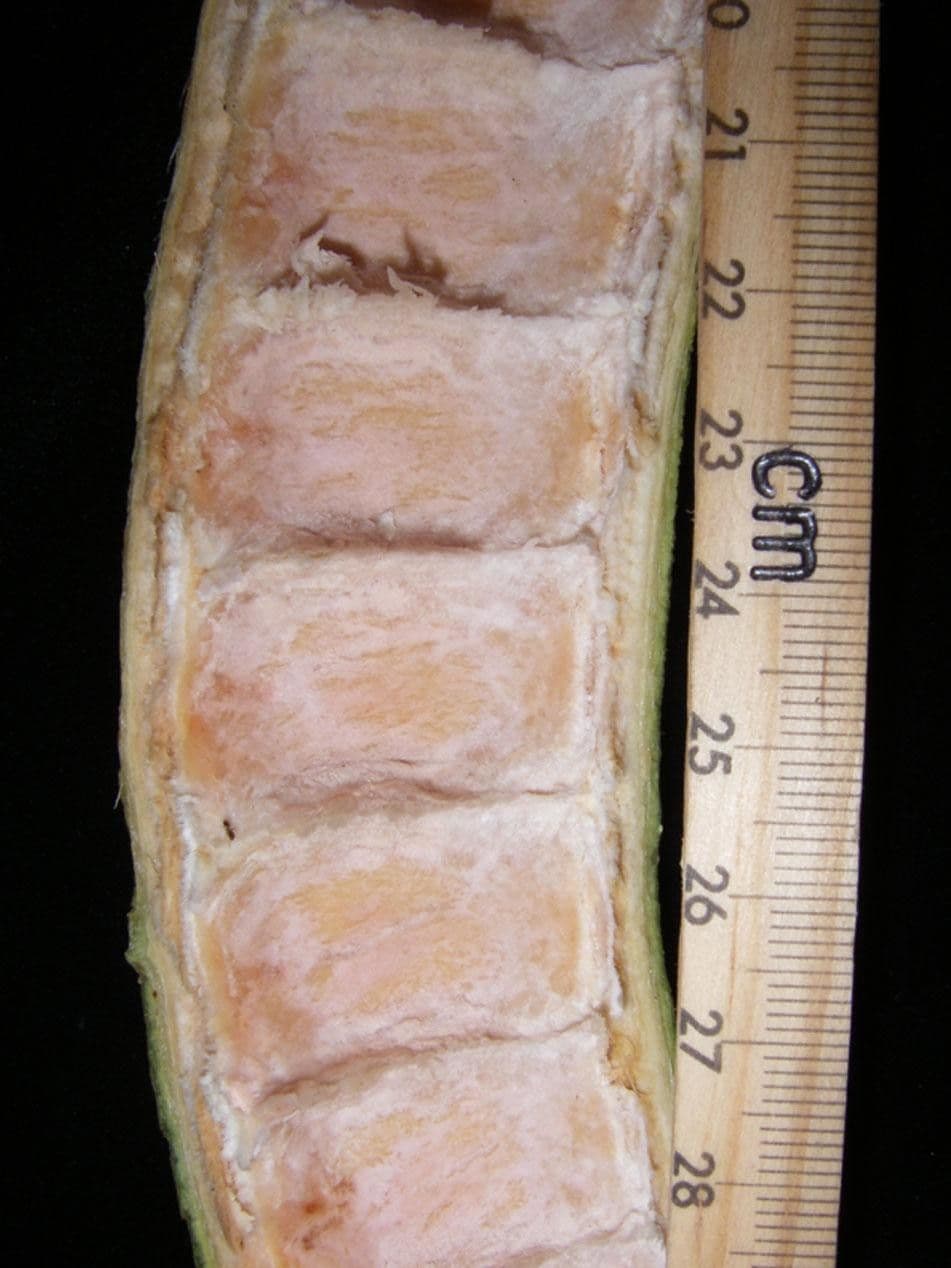 Inga 17