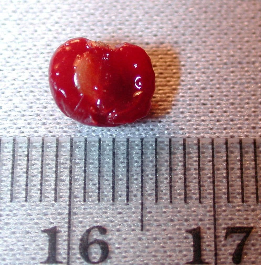 Psychotria 12