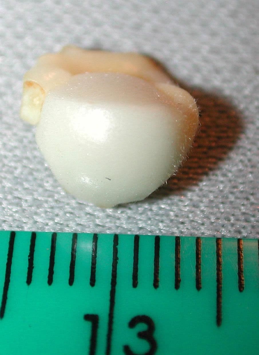 Carpotroche 22